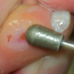 Dimanta slīpēšanas frēze, 830-070