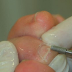 Dimanta slīpēšanas frēze, 854-033